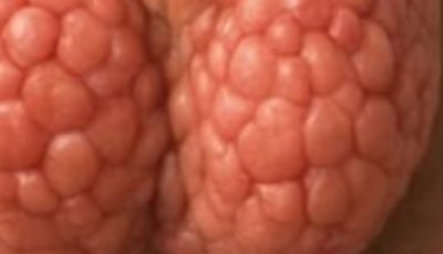6 Simple Steps to Support Thyroid Health Naturally