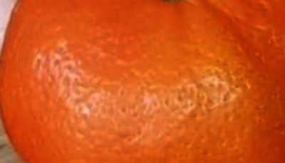 Cleanse Your Kidney, Liver, and Lungs: The Bacterial-Killer Combo of Mandarins and Ginger